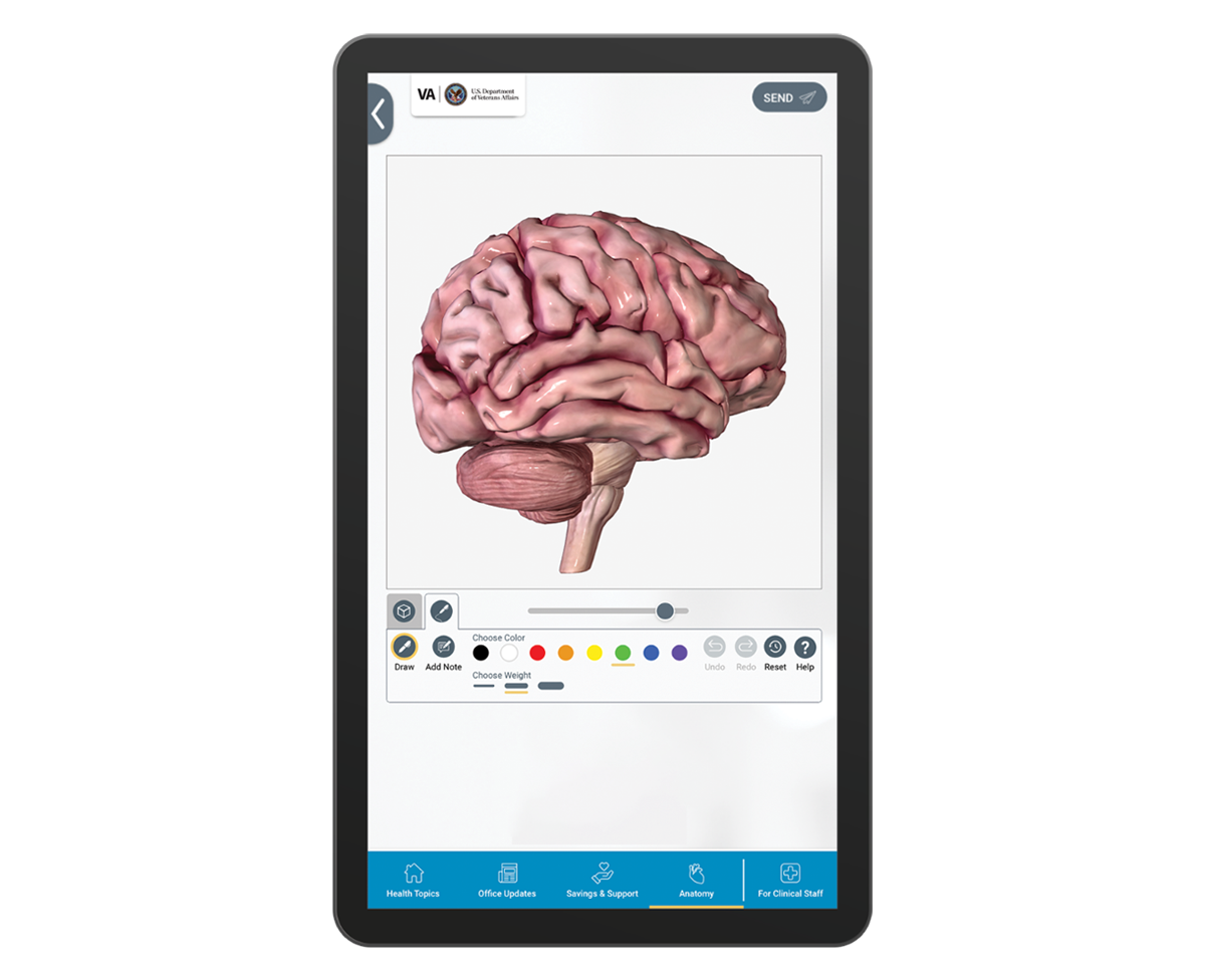 PatientPoint interactive medical touch screen displaying a digital anatomical model of the human brain. 