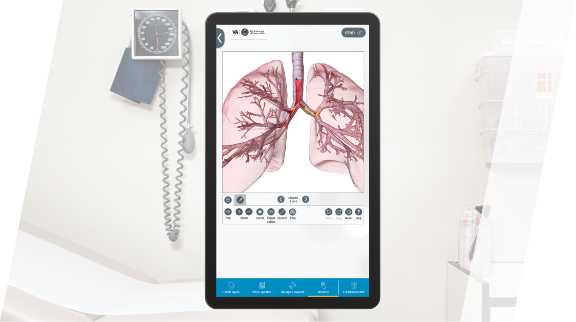 PatientPoint interactive medical touch screen in the exam room displaying a digital anatomical model of the lung heart.